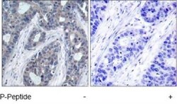 IRS1, p Ser636 Antibody, Novus Biologicals 0.025 mL; Unconjugated:Antibodies,